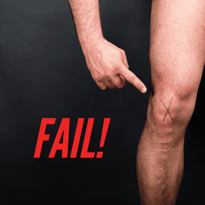 Acl rehab fail