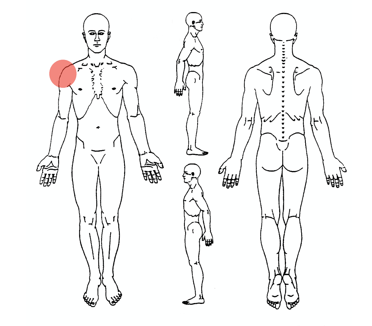 Saps pain diagram