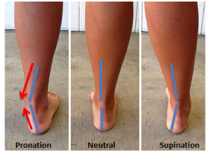 Ankle pronation position