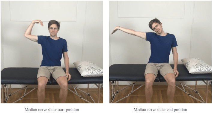 Neurodynamic treatments for Thoracic Outlet Syndrome — Rayner & Smale