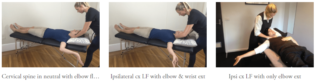 Neurodynamic treatments for Thoracic Outlet Syndrome — Rayner & Smale