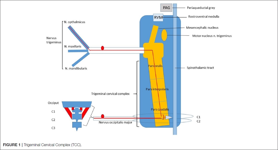 Xtensal Training in Wellness - ✓ Dolor de cabeza de origen #cervical. 📍 El  dolor de cabeza de origen cervical es un tipo de cefalea cuyos síntomas se  originan a raíz de