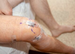 ACL Rehab