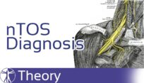 Neurological thoracic outlet syndrome