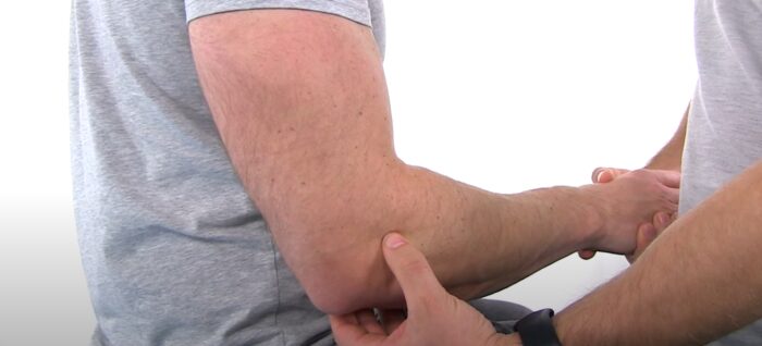 SALT Test | Elbow Laxity Assessment | Intra-articular Findings
