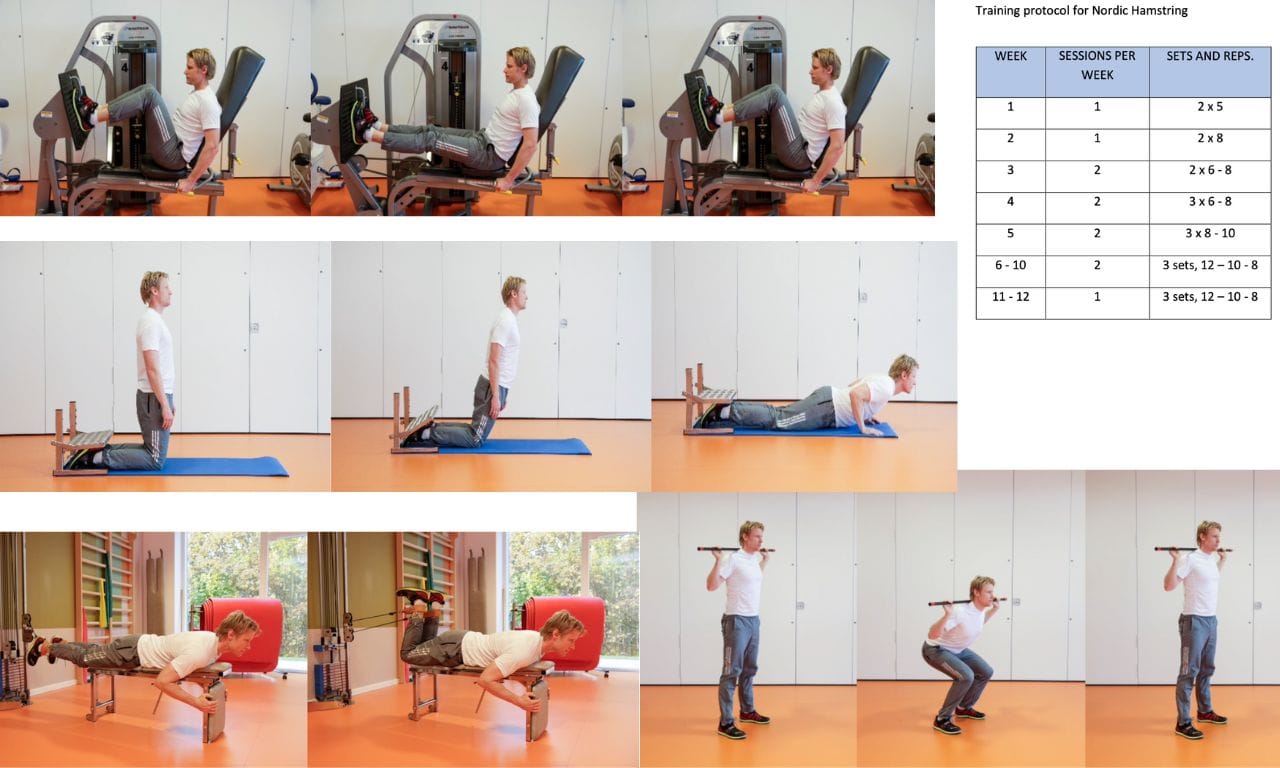 Progressive strengthening in persistent hamstring deficient ACL reconstructions