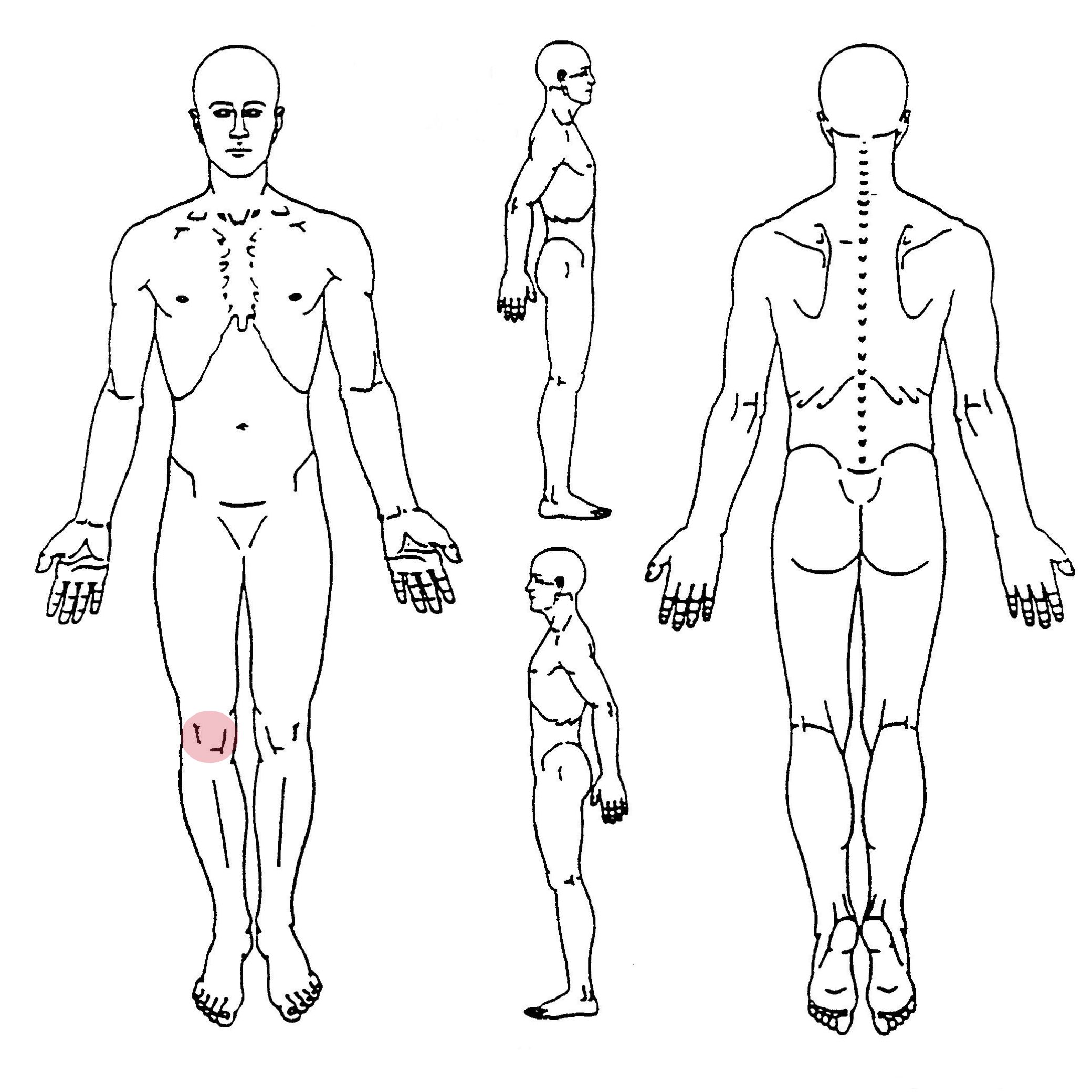 Patellar instability pain diagram