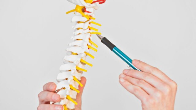 Radiculopatia dolorsa cervicale e suo trattamento