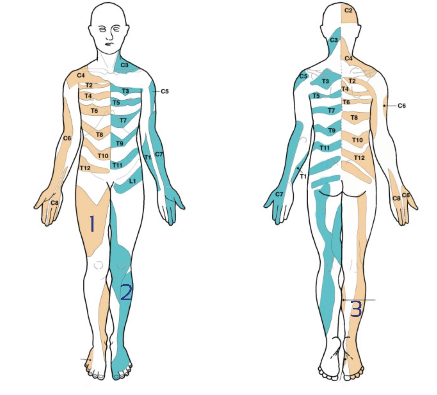 Lee et al. dermatome map