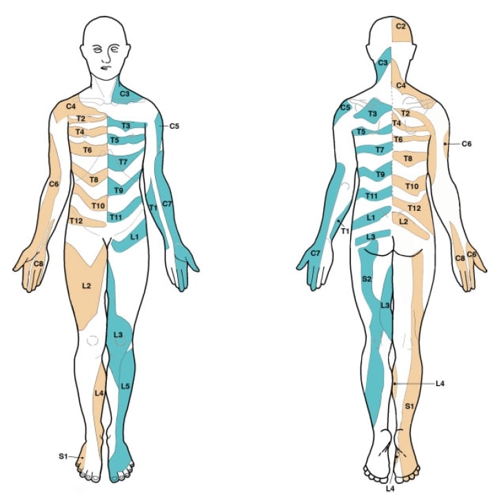 Lee et al. 2008 dermatome map