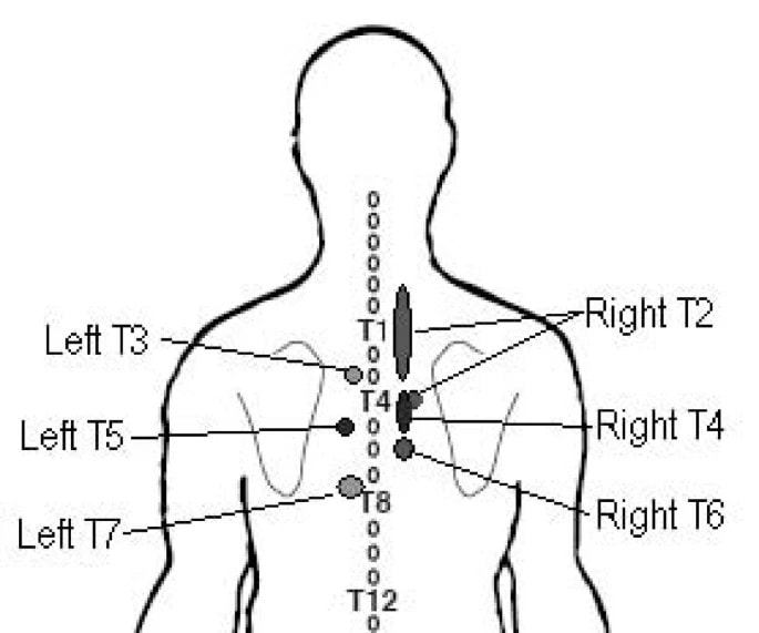 Dolor de espalda irradiado: ¿Qué significa?