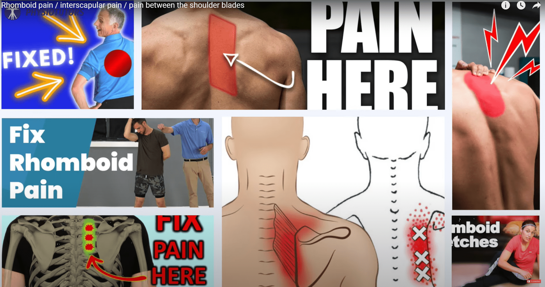 Rhomboid Pain / Interscapular Pain