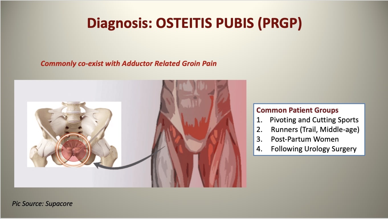 Flank pain radiating to the suprapubic region