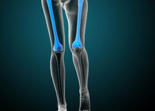 hip strength after ACL reconstruction