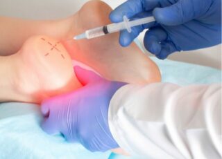 plantar fasciopathy