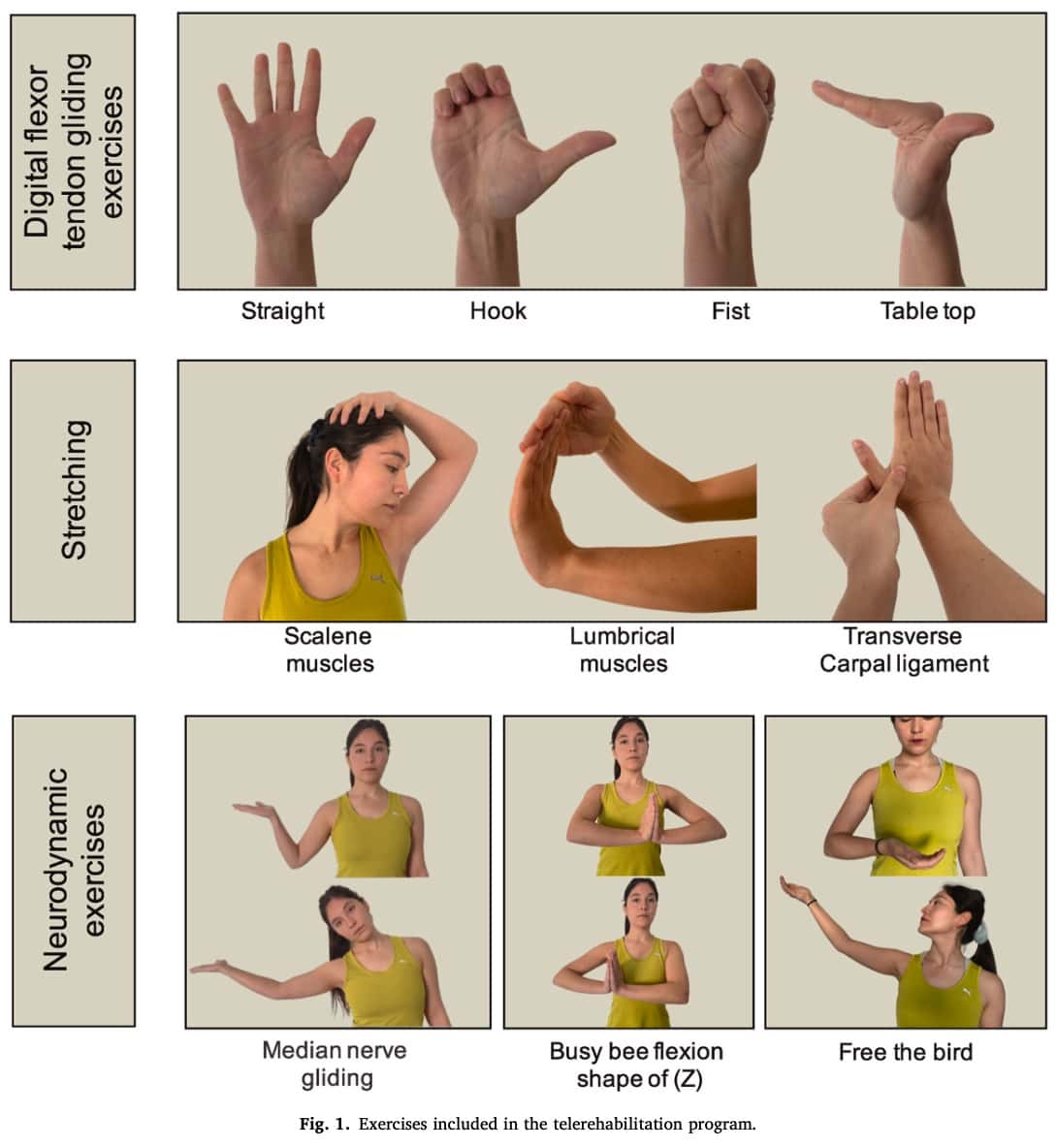 Sindrome del túnel carpiano. Ejercicios y tratamiento