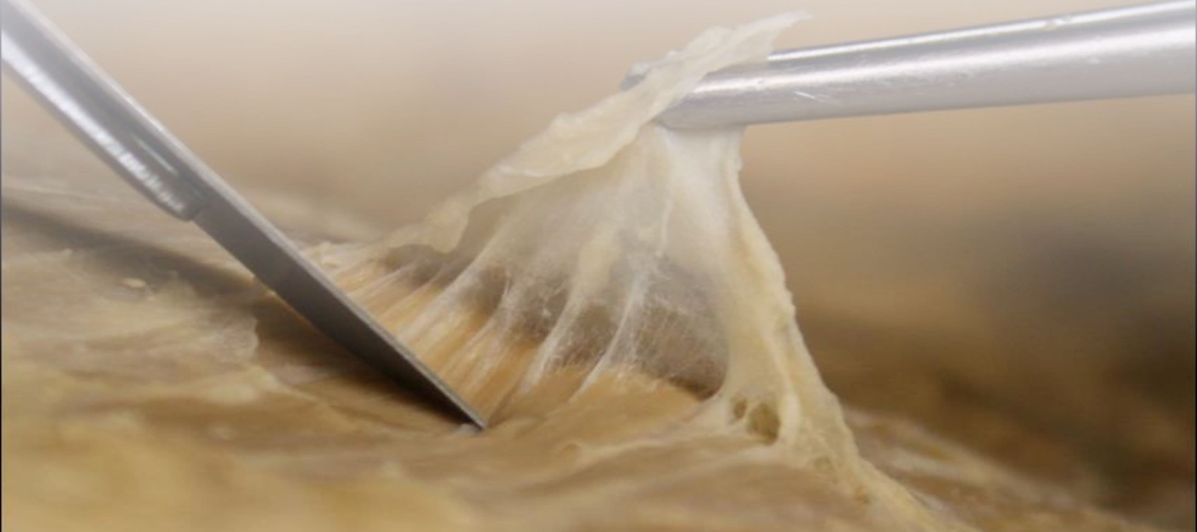 Fascia in a Nutshell Masterclass by anatomist Karl Jacobs