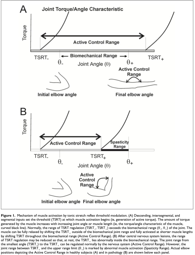 spasticity biomarkers after stroke