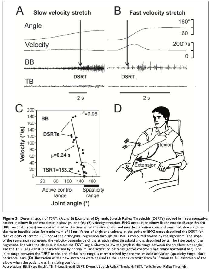 spasticity biomarkers after stroke