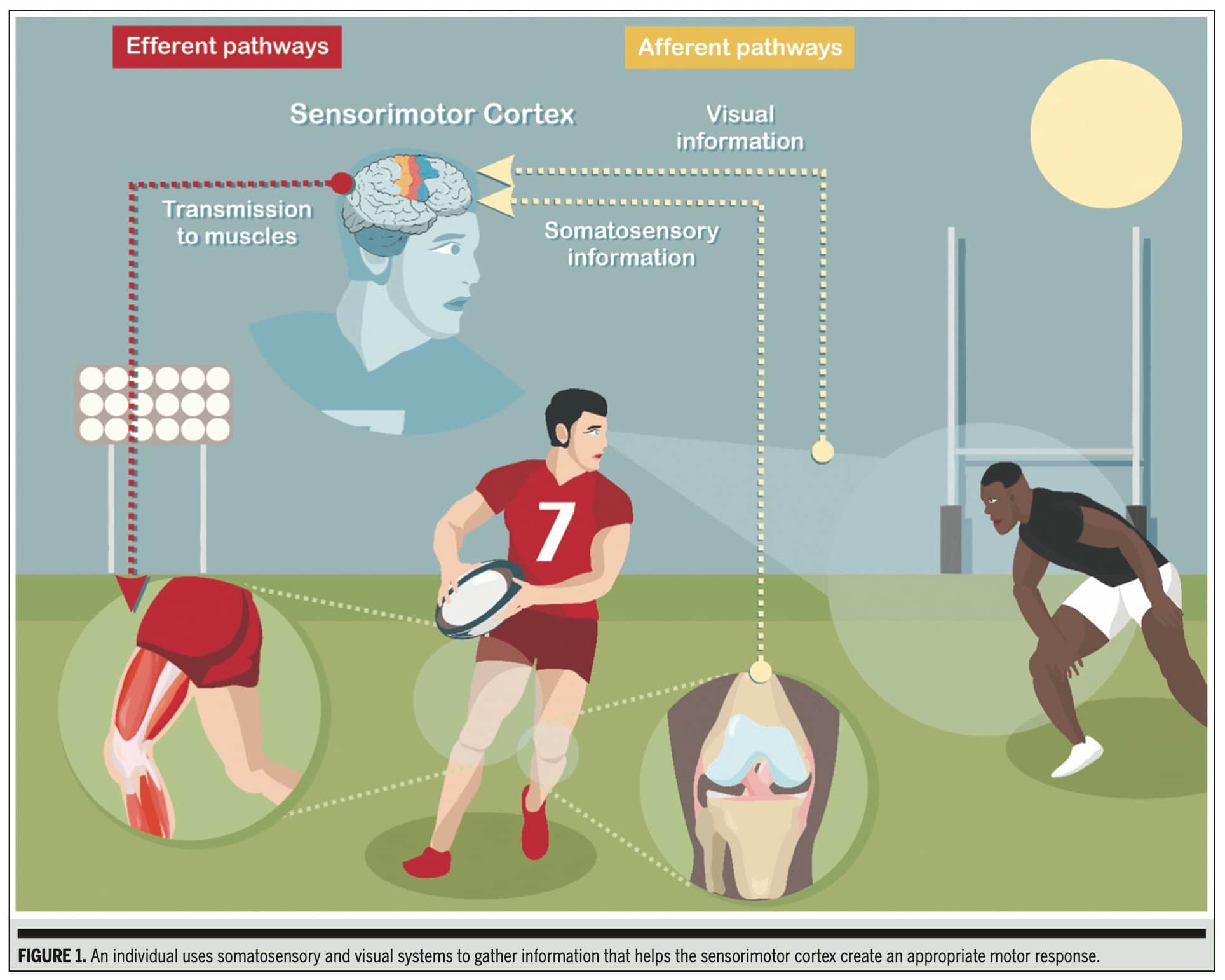 Sensorimotor Dysfunction Following ACL Injury