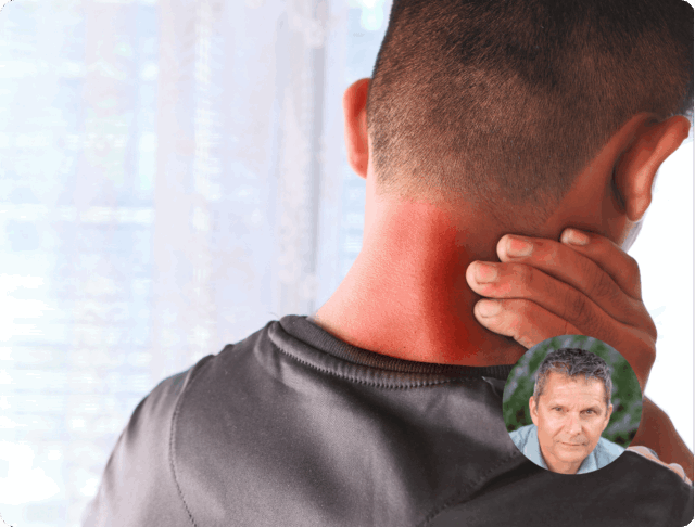Cervical Radicular Syndrome