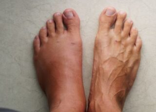 Rehabilitation interventions for crps