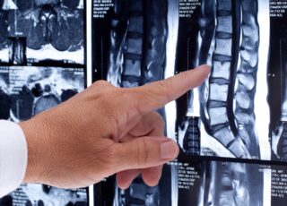 Mobilization for herniation regression