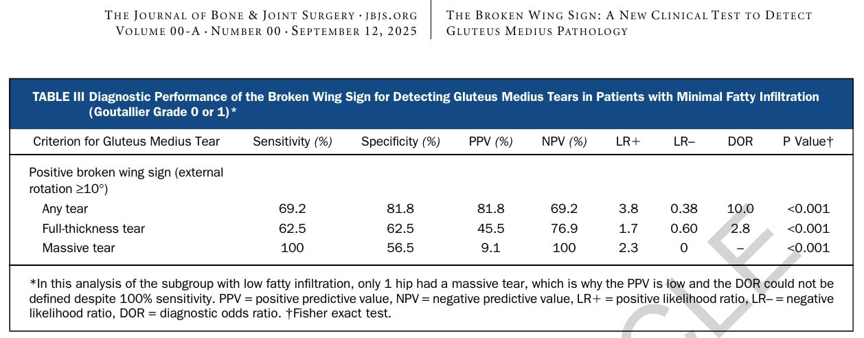 diagnóstico de los desgarros del tendón del glúteo medio