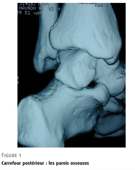 後足関節重心症候群