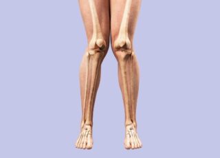 Bekkenoefeningen voor knievalgus