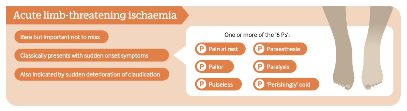 arteriální onemocnění dolních končetin