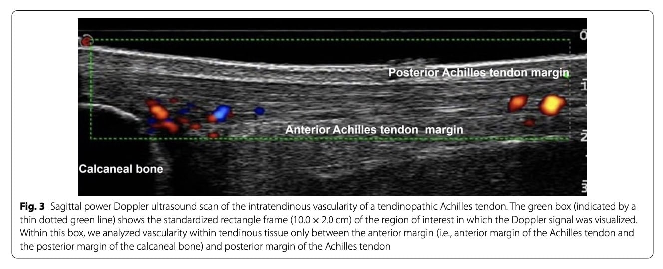 Nagy terhelést igénylő gyakorlat az ínok számára