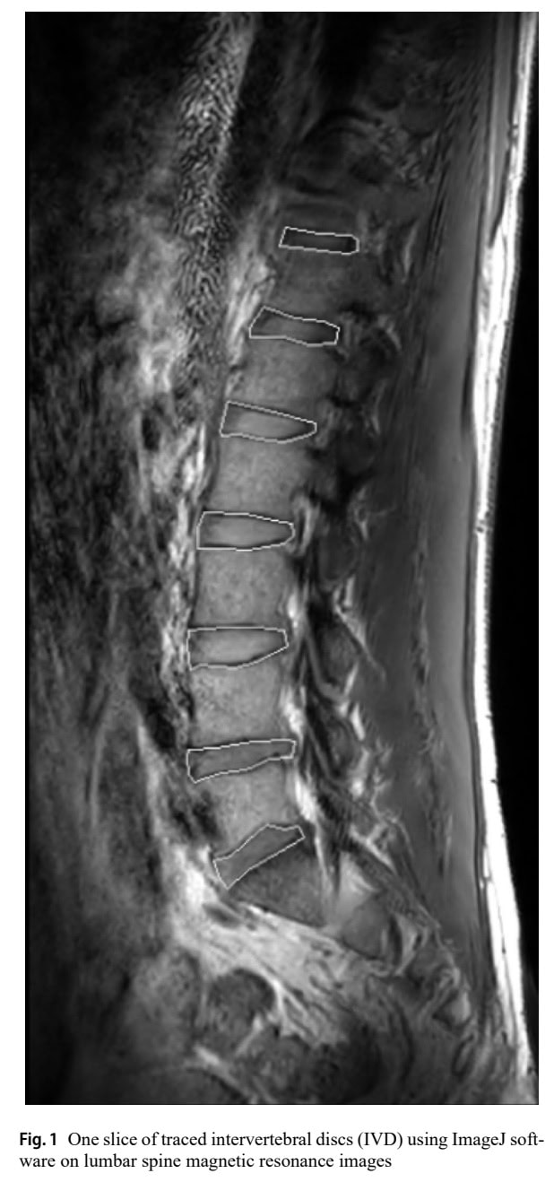 Адаптация дисков, вызванная бегом