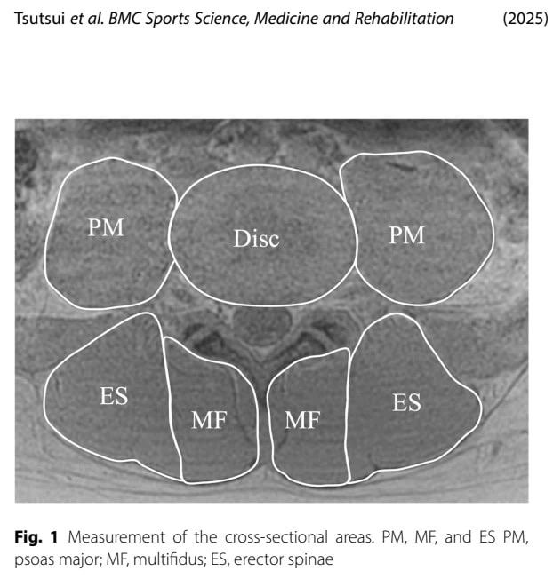 Lumbopelvic Control in Unilateral Lumbar Spondylolysis