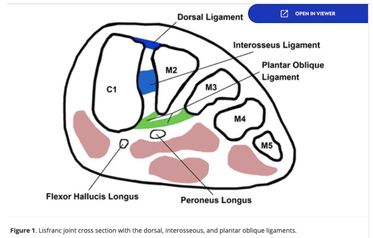 Lisfranc injury diagnosis
