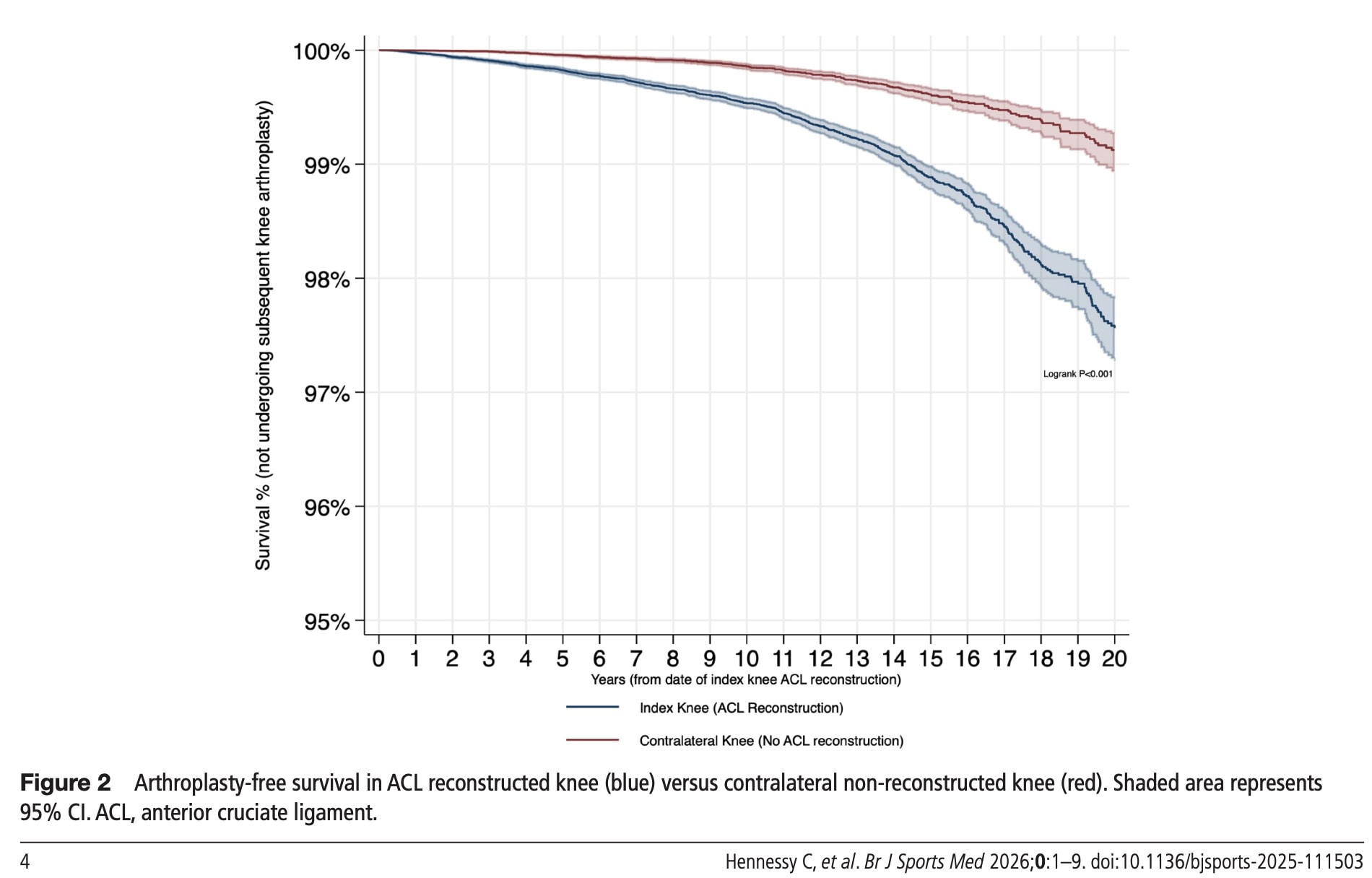 knee replacement risk after ACL reconstruction